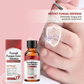 💅🌟 Nägel Reparatur Essenz – Stärkt & regeneriert beschädigte Nägel in 7 Tagen! ✨💪 Sichtbare Ergebnisse, dermatologisch getestet. Deine Lösung für starke, gesunde Nägel.